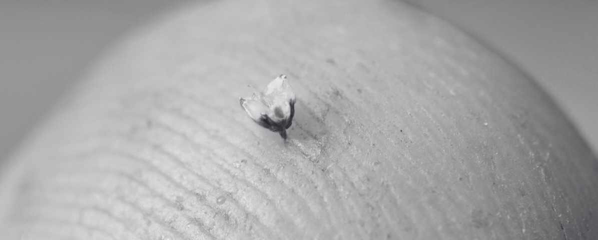 Everything You Need to Know About Bee Sting