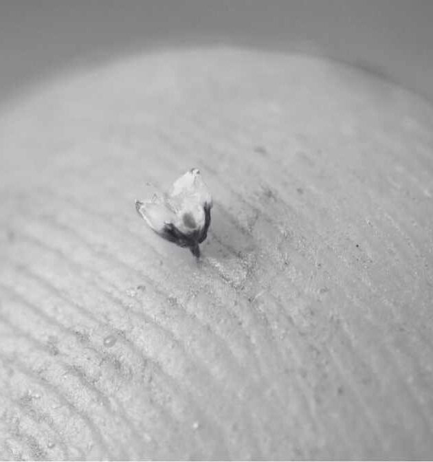 Everything You Need to Know About Bee Sting