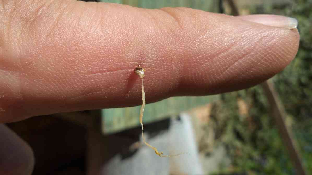Everything You Need to Know About Bee Sting - Ease Irritation